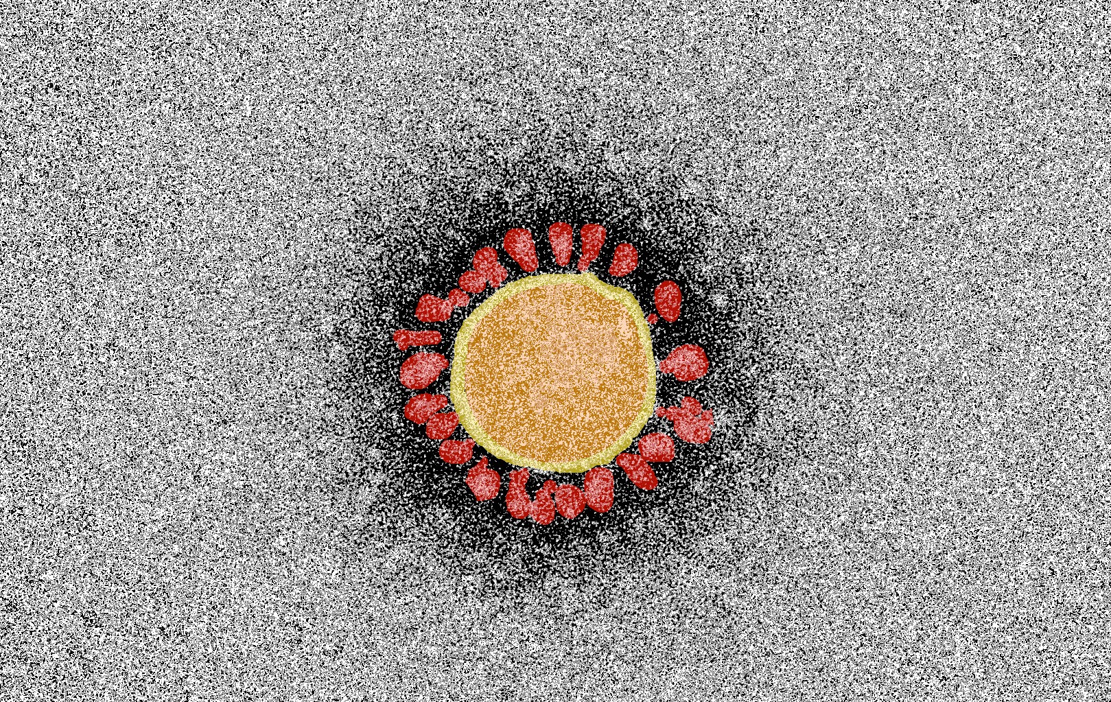 Klinische Tests für Impfstoff gegen SARSCoV2 können noch im September